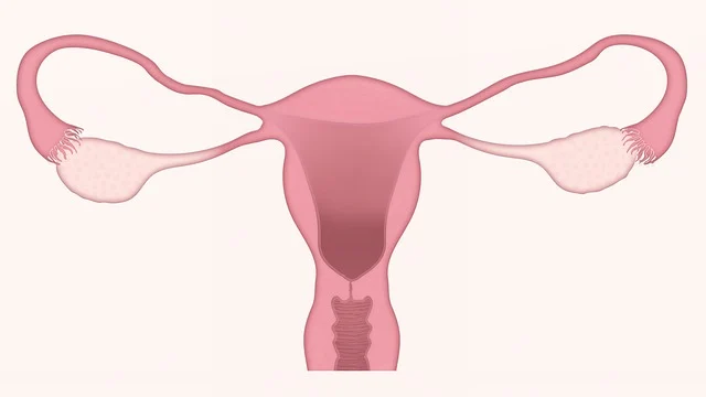 输卵管堵塞或切除的女性